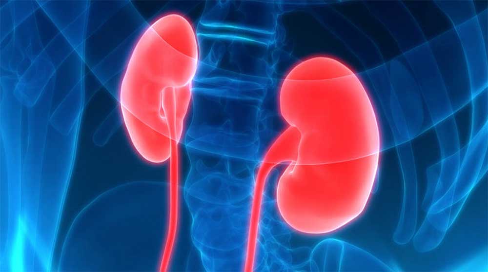 kanser belirtileri, böbrek, böbrek kanseri belirtileri, kanser belirtileri